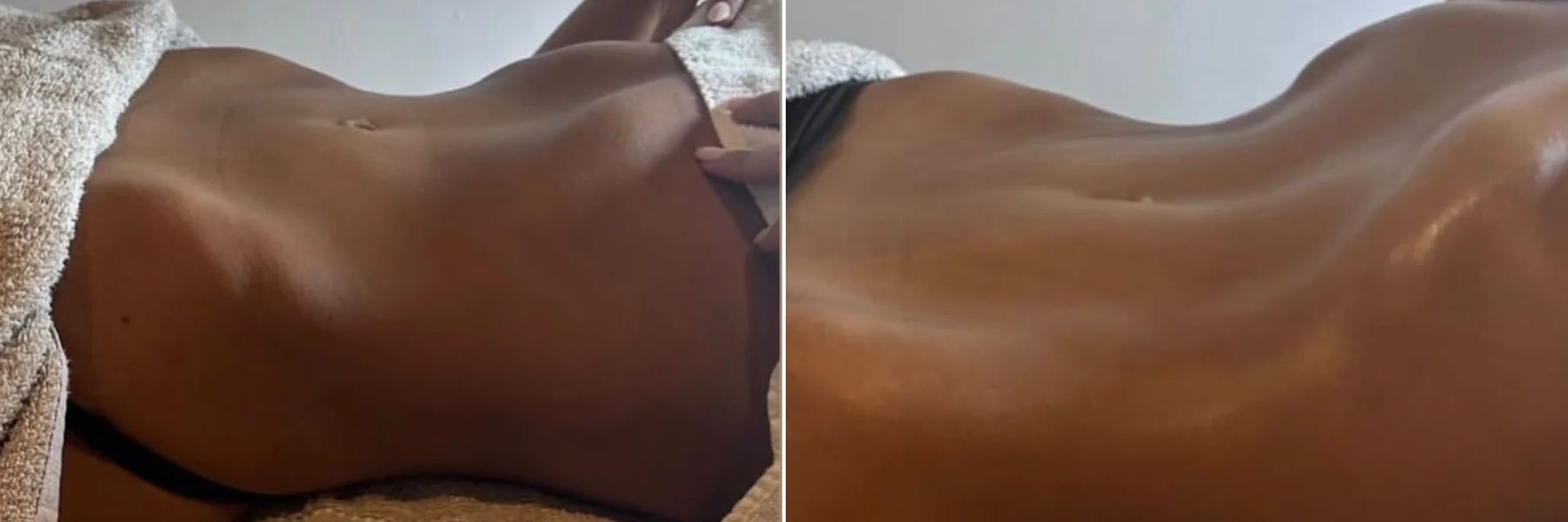 Waist before and after a single lymphatic drainage session